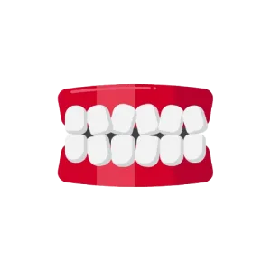 Crossbite