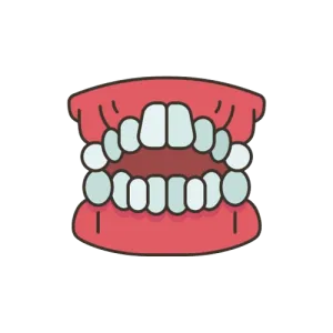 Open bite
