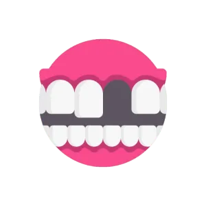 Gaps between teeth