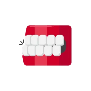 Underbite