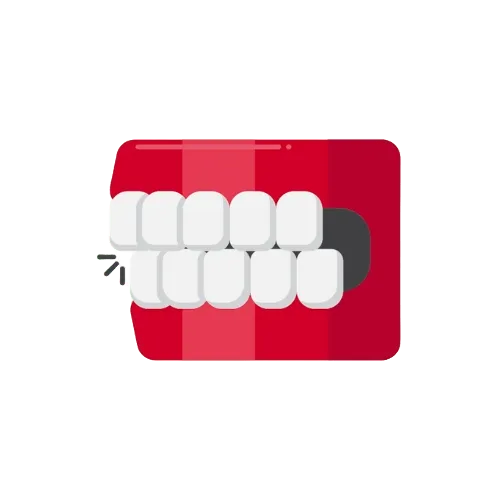 Overbite